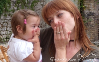 mamma e figlia con sindrome di down