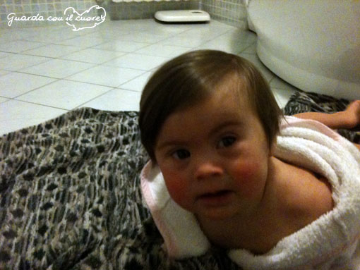 bambina con sindrome di down