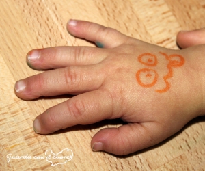 mano bambina con sindrome di down