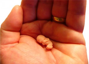 aborto terapeutico